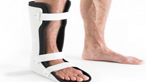 بریس و ارتوز چه کمکی به بیمار میکند