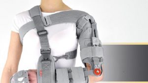 ارتوزهای اندام فوقانی