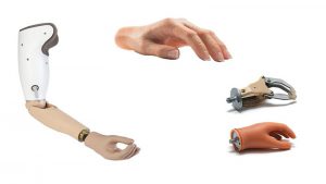 پروتزهای اندام فوقانی