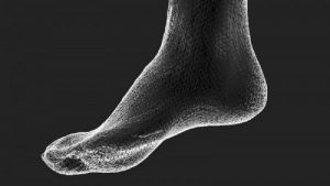 اسکن استاتیک کف پا