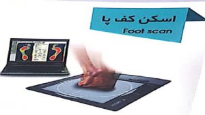 مشاوره اسکن کف
