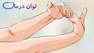 سندروم داکوران