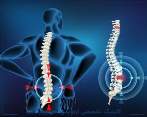 تشخیص و درمان دیسک بینمهرهای