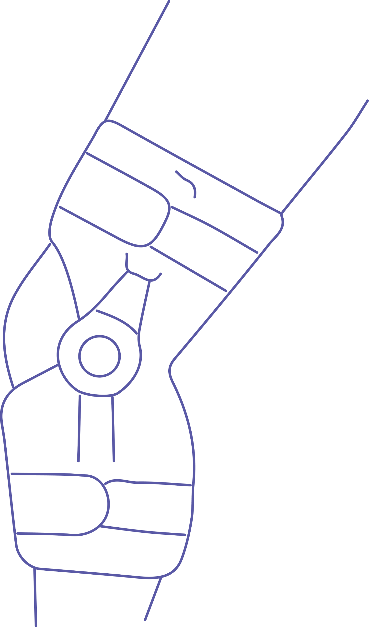 ارتز در کلینیک ارتوپدی فنی پویا طب در تهران جردن و خرم آباد