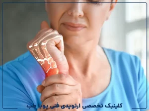 استئوپروز در زنان پس از یائسگی