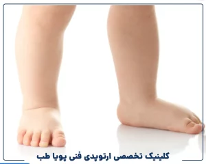 درمان تخصصی صافی کف پا کودکان بدون جراحی